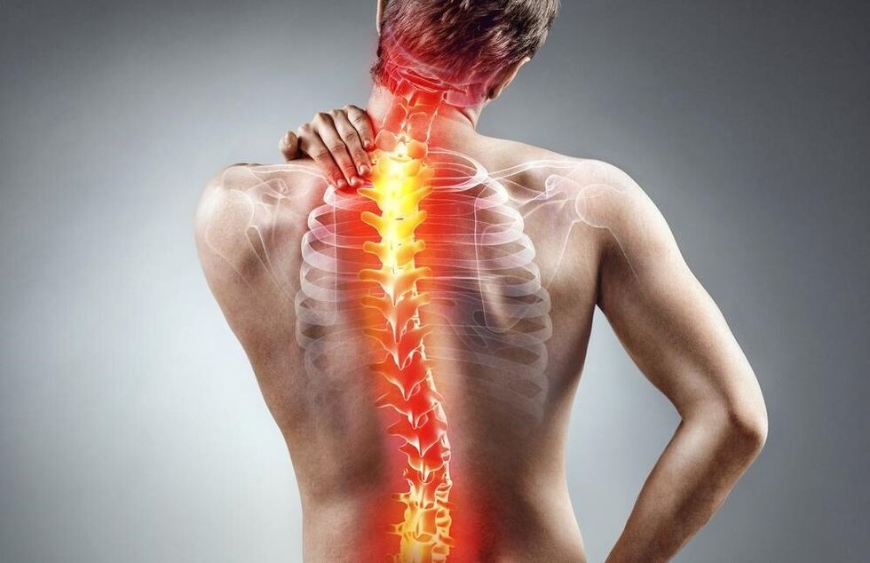 Rücken tut weh bei Osteochondrose