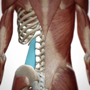 Schmerzen können in verschiedenen Bereichen des Rückens auftreten