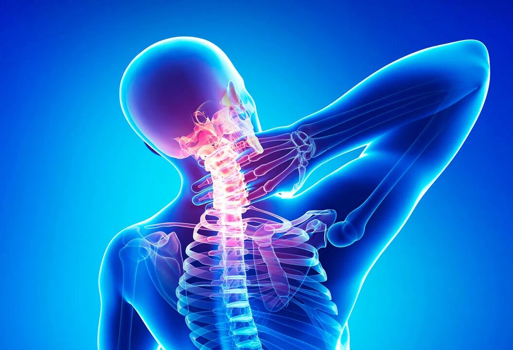 Osteochondrose der Wirbelsäule ist eine häufige Erkrankung, die einer Behandlung bedarf. 