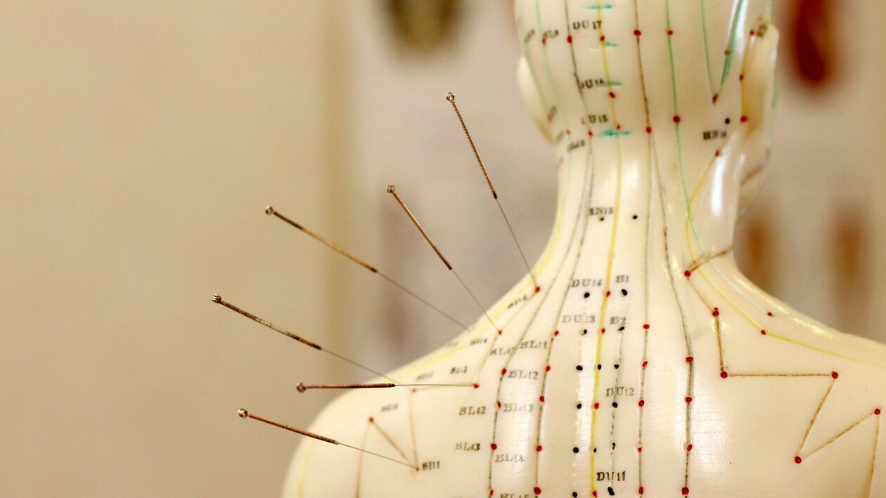 Akupunktur bei zervikaler Osteochondrose