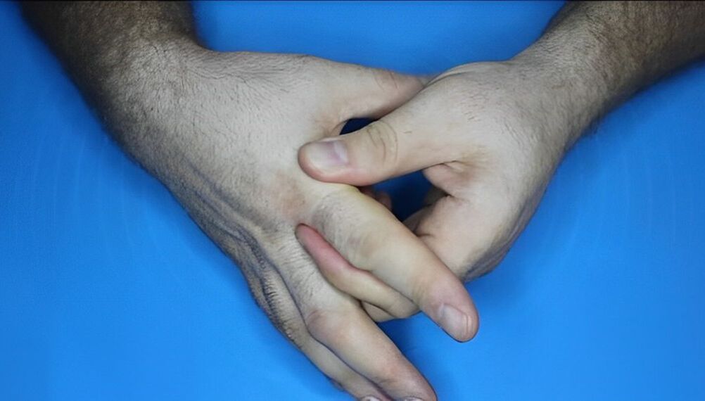 Übungen für Finger mit Arthrose