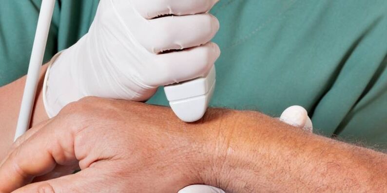 Arthritis als Ursachen für Schmerzen in den Fingern Gelenke