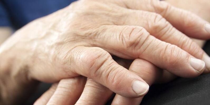 Bei welchen Pathologien weh tun die Gelenke der Finger weh tun